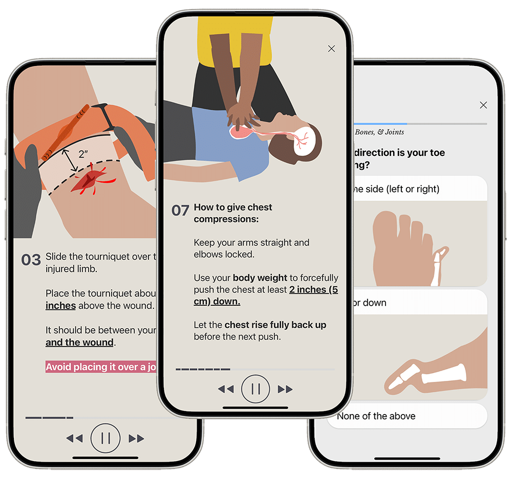 Three smartphones display step-by-step instructions for emergency care